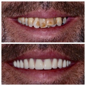 Before and after dental treatment photo