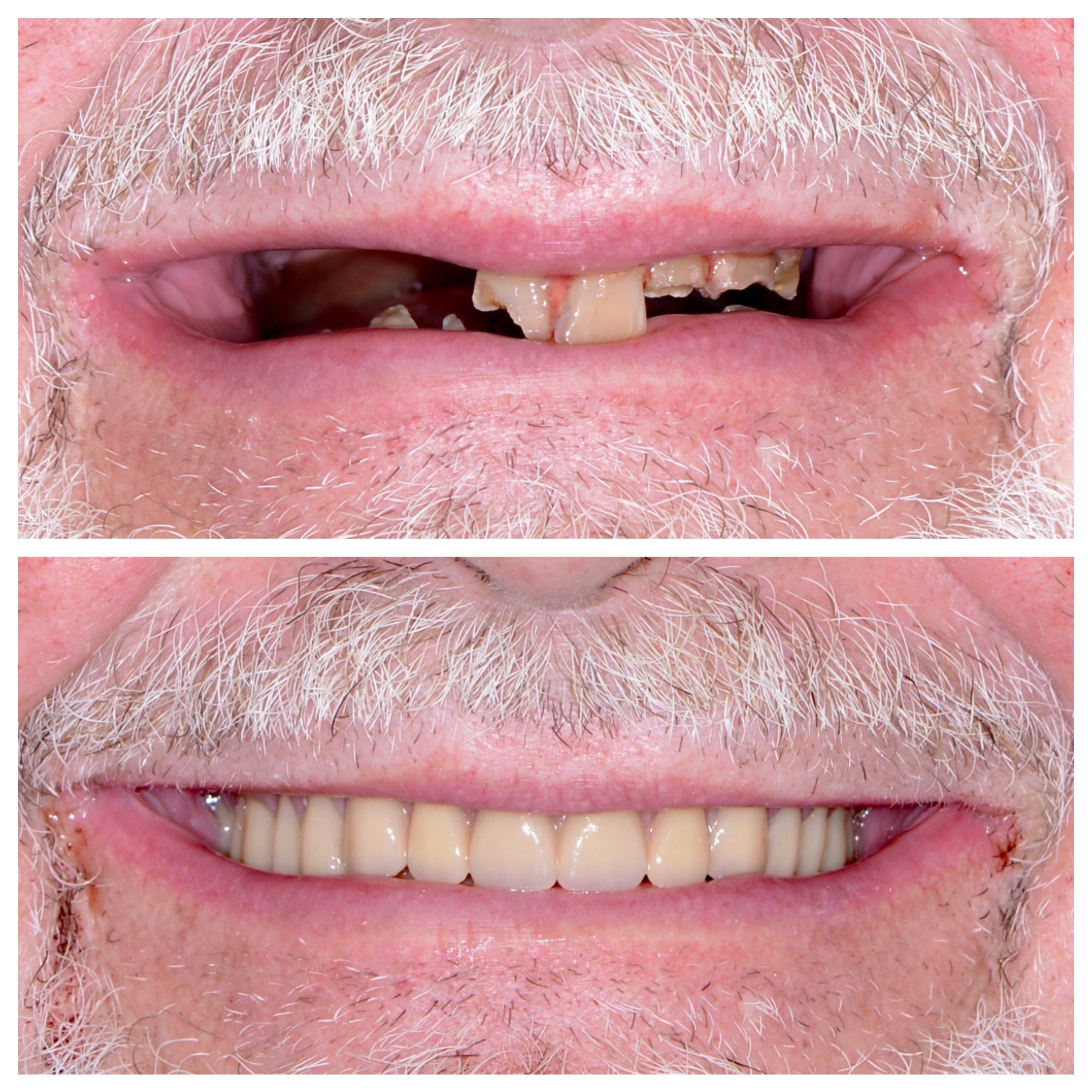 Smile Gallery DentureCare and Implant Solutions Rocky Mount NC