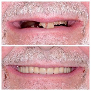Before and after dental treatment photo