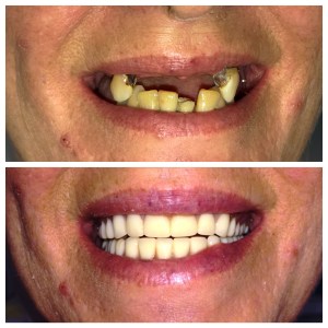 Before and after dental treatment photo